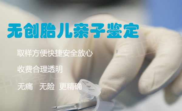 徐州孕期亲子鉴定需要怎么做,徐州产前亲子鉴定结果准吗 徐州孕期亲子鉴定需要怎么做,徐州产前亲子鉴定结果准吗